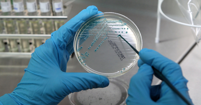 Bacteria culture in a Petri dish